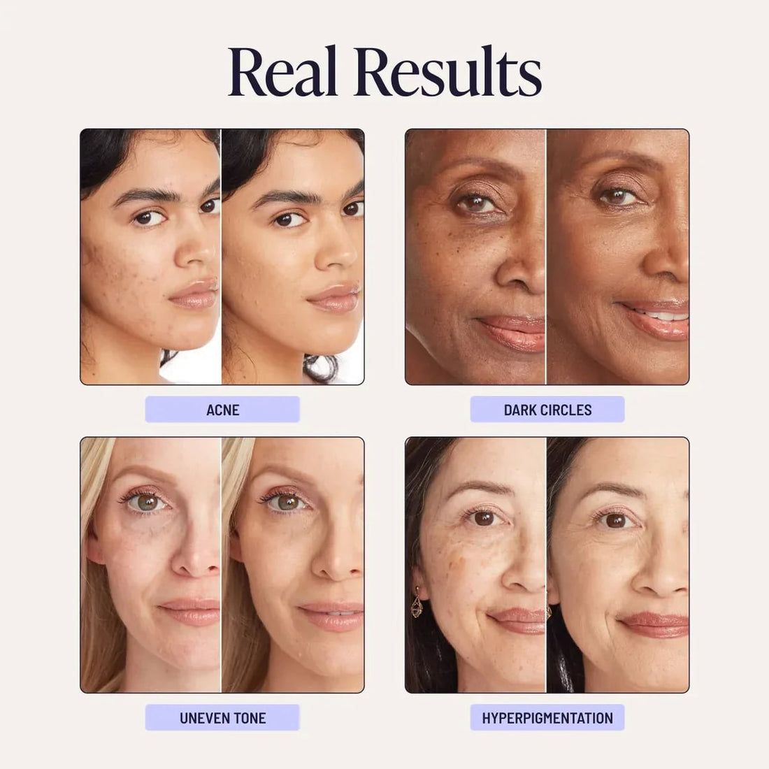 Complexe de peptides